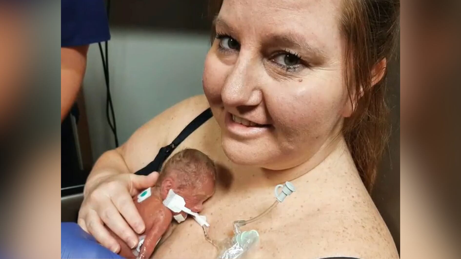 'The ultimate miracle': Baby born at just 13 ounces comes home after 378 days at hospital - Vimarsana News